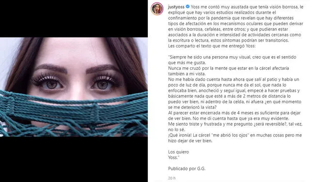 8.11.2021 | Publicación de YosStop hablando de su salud ocular. Foto: captura Yoseline Hoffman / Instagram