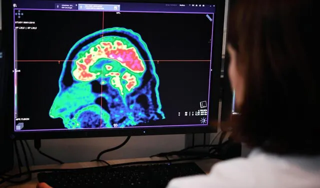 tomografía cerebro humano