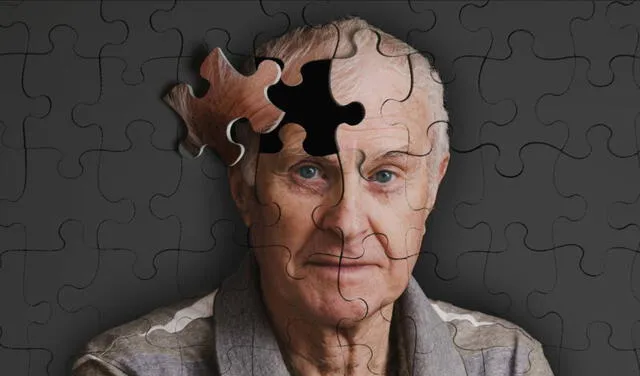 Alzheimer demencia