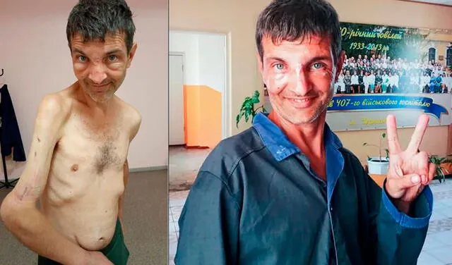 El desolador antes y después de un soldado ucraniano tras 82 días cautivo por los rusos