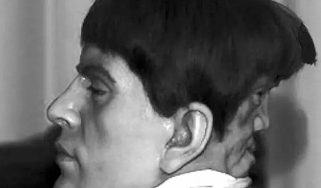 La verdadera historia de Edward Mordrake, el hombre con 2 caras: ¿real o ficción?