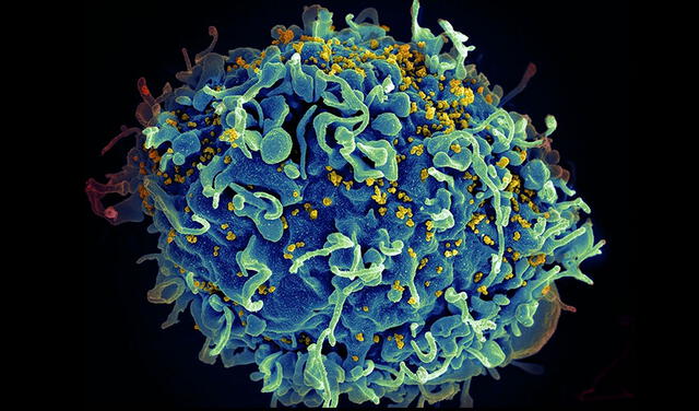 Partículas de VIH emergen de una célula infectada. Foto: NIH