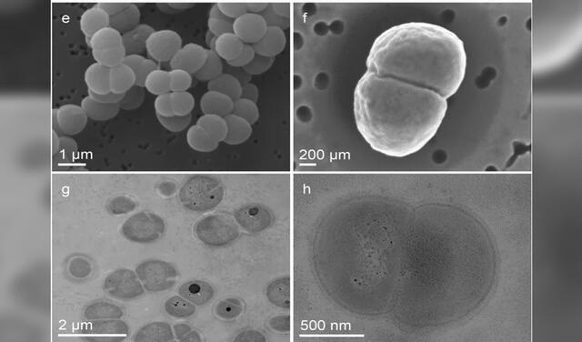 Imágenes de microscopía electrónica de D. radiodurans recuperadas después de la exposición hostil | Foto: Estudio de Microbioma