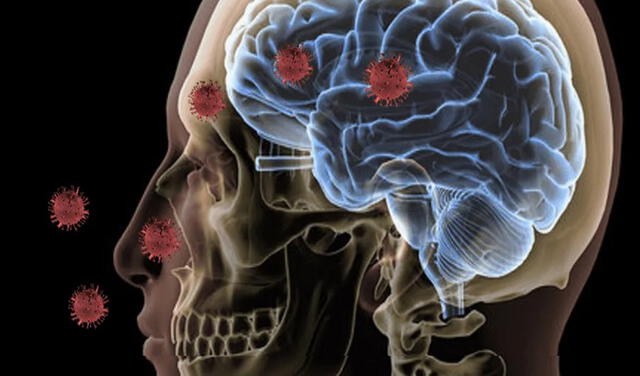 Investigadores de la Universidad de Londres habían afirmado que el cerebro de una persona contagiada del nuevo coronavirus envejece 10 años | Foto: La verdad noticias / Estudio Foto Science