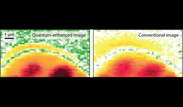 Fotos: Warwick Bowen