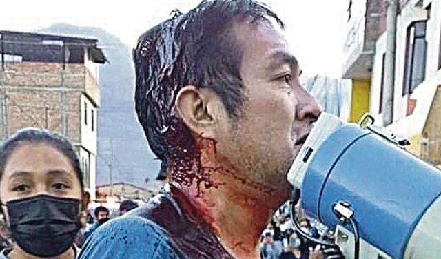 Golpazo. En Caraz, fujimorista le rompió la cabeza  al comunicador Edgar Moreno, excandidato del PPC. Foto: difusión