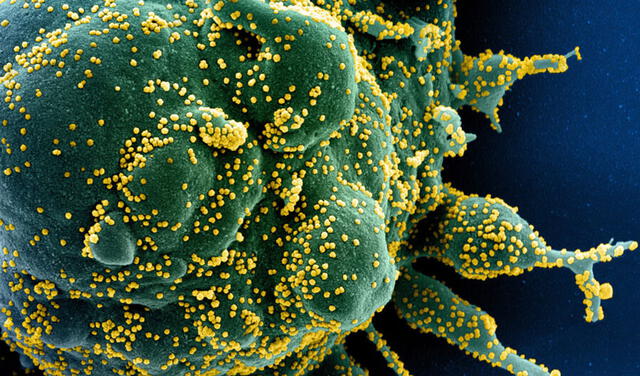 Partículas de SARS-CoV-2 salen de una célula infectada. Foto: CDC