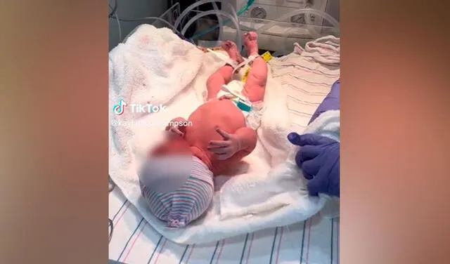 Mujer va al médico creyendo que tiene apendicitis, pero da a luz a su bebé de emergencia