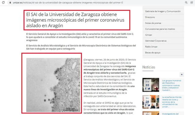 SAI aisló al coronavirus y muestra imágenes microscópicas. Foto: captura en web /  Universidad de Zaragoza.