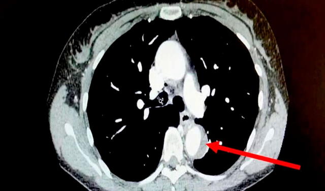 Mujer casi muere durante un orgasmo: sintió un “estallido” en su pecho por un mal cardiaco