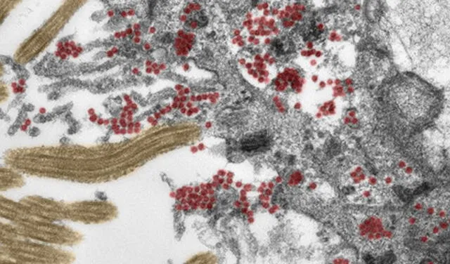 Sección de una célula en la mucosa olfativa infectada por un gran número de partículas de SARS-CoV-2 (puntos rojos). Foto: Michael Laue/RKI & Carsten Dittmayer/Charité