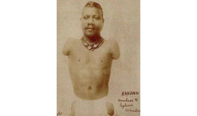  Fotografía de Radian. Fuente: anónimo   