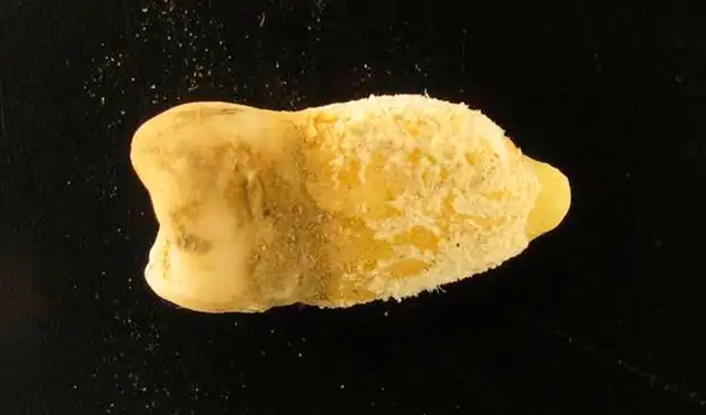 Este diente perteneció a un joven que vivió en el Altiplano boliviano hace unos 700 años. Los investigadores encontraron en él la bacteria estreptococo del grupo A. Foto: Guido Valverde/Eurac Research