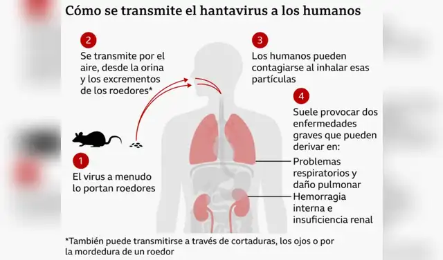Hantavirus, cepa Andes hantavirus, hantavirus peru, hantavirus que es, hantavirus sintomas, Minsa