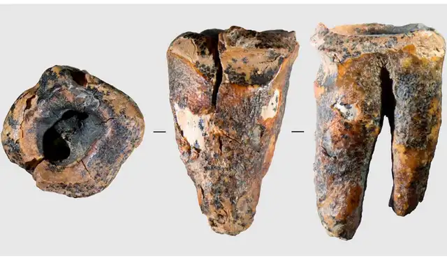 El hallazgo se convierte en la evidencia más antigua de la odontología hasta la fecha. Foto: PLOS One El hallazgo se convierte en la evidencia más antigua de la odontología hasta la fecha. Foto: PLOS One