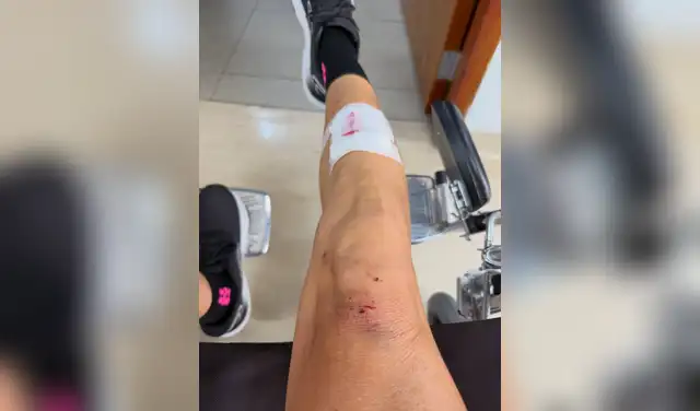 Anna Carina Copello reveló imagen tras su accidente