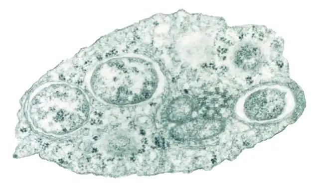 Micrografía electrónica de transmisión de Wolbachia dentro de una célula de insecto. Foto: Wikimedia Micrografía electrónica de transmisión de Wolbachia dentro de una célula de insecto. Foto: Wikimedia