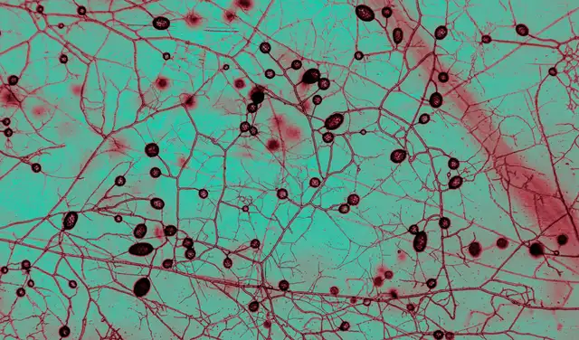 Hongos micorrícicos bajo el microscopio en el instituto de biofísica AMOLF en Ámsterdam. Las estructuras circulares son esporas. Foto: Tomás Munita