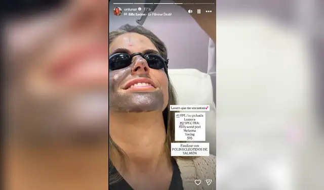 Stephanie Cayo, pareja de Alejandro Sanz, compartió su tratamiento facial no invasivo. Foto: captura Instagram Stephanie Cayo, pareja de Alejandro Sanz, compartió su tratamiento facial no invasivo. Foto: captura Instagram