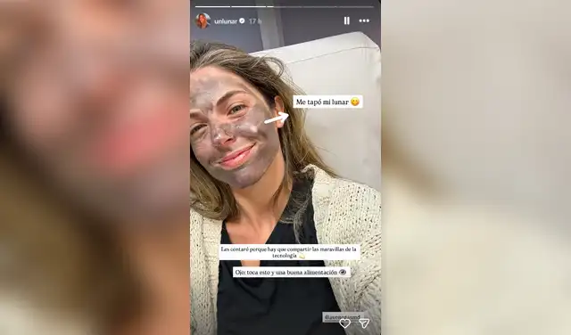 Stephanie Cayo, pareja de Alejandro Sanz, compartió su tratamiento facial no invasivo. Foto: captura Instagram Stephanie Cayo, pareja de Alejandro Sanz, compartió su tratamiento facial no invasivo. Foto: captura Instagram