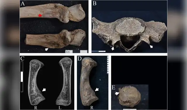 Lesiones de Hor: cúbito (A), sacrolumbar (B), rayos X de metacarpianos (C), callo por trauma (D) y línea de fractura (E). Foto: Frontiers in Environmental Archaeology Lesiones de Hor: cúbito (A), sacrolumbar (B), rayos X de metacarpianos (C), callo por trauma (D) y línea de fractura (E). Foto: Frontiers in Environmental Archaeology