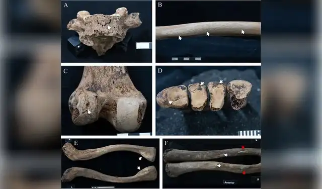 Daños de Itaweret: vértebra (A), fémur (B,C), fracturas en pie (D) y robustez muscular/ligamento en clavículas (E,F). Foto: Frontiers in Environmental Archaeology Daños de Itaweret: vértebra (A), fémur (B,C), fracturas en pie (D) y robustez muscular/ligamento en clavículas (E,F). Foto: Frontiers in Environmental Archaeology