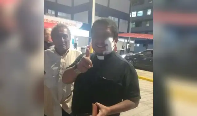 Pese a resultar herido en el rostro, el sacerdote salió del hospital al no correr peligro.