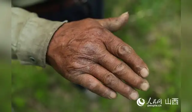 La foto muestra la mano de Wang Zhanfeng. Foto: Diario del Pueblo en línea/Wang Fan