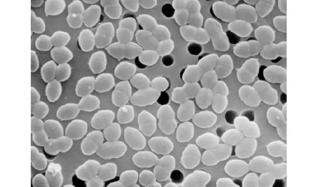 Los e. faecium normalmente colonizan el tracto digestivo humano. Foto: Wikimedia