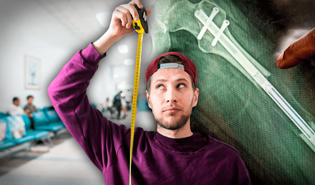 Romperse las piernas para crecer: ¿cómo es la cirugía estética por la