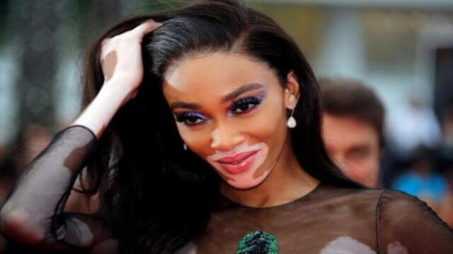 Maluma publica fotografía junto a su nueva novia, la modelo Winnie Harlow |  FOTOS | ATMP | Espectáculos | La República