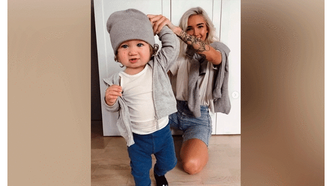Instagram Bebé Nace Con Extraña Enfermedad En La Piel Y Su Madre Ekaterina Mezenova Lo Presume 7105