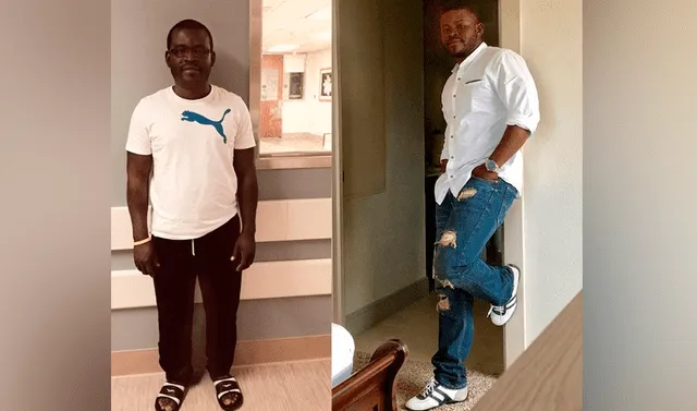  Antes y después de la cirugía a la que fue sometido Moses Gibson para alargar sus piernas. Foto: The Mirror    
