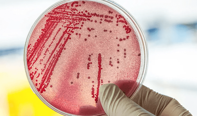  Algunas cepas de Escherichia coli pueden causar graves enfermedades gastrointestinales. Foto: Biomes   