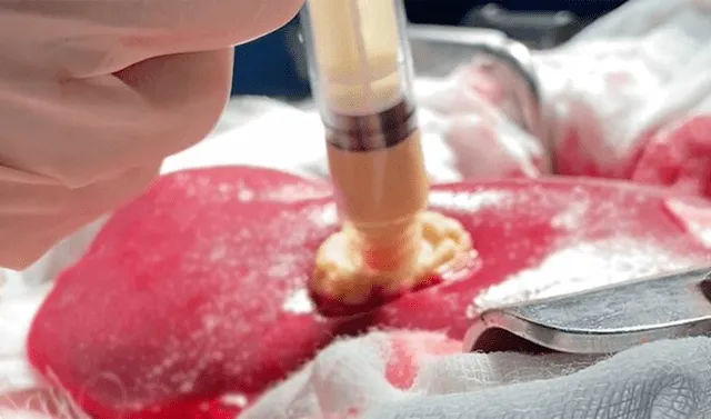 Aplicación de Traumagel. Foto: Cresilon   