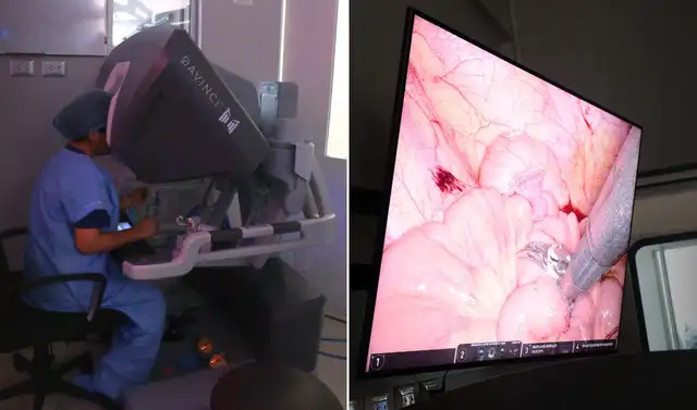 La cirugía Whipple es una de las más riesgosas del mundo, donde suelen sobrevivir cuatro de cada diez pacientes. Foto: Jhonatan Sánchez/La República. La cirugía Whipple es una de las más riesgosas del mundo, donde suelen sobrevivir cuatro de cada diez pacientes. Foto: Jhonatan Sánchez/La República.