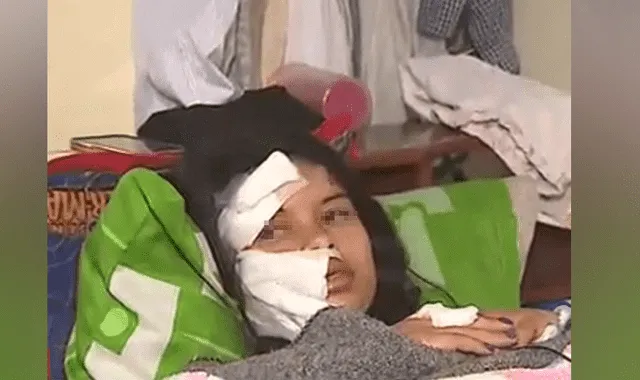 Piden 9 meses de prisión para enfermero que desfiguró con bisturí a su expareja en bus