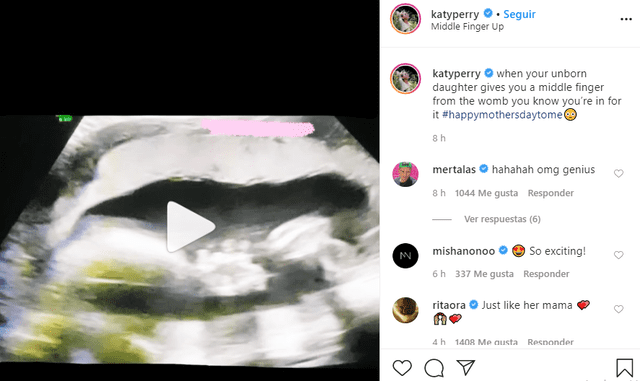 Katy Perry comparte el ultrasonido de su bebé en Instagram.