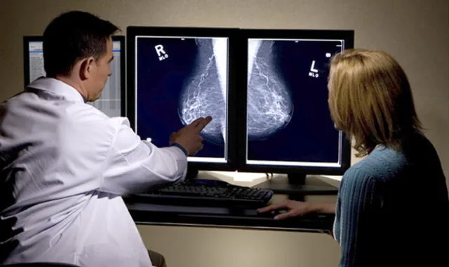 ¿Cómo me hago un autoexamen de mama? Estos son los signos de alarma que debes tener en cuenta