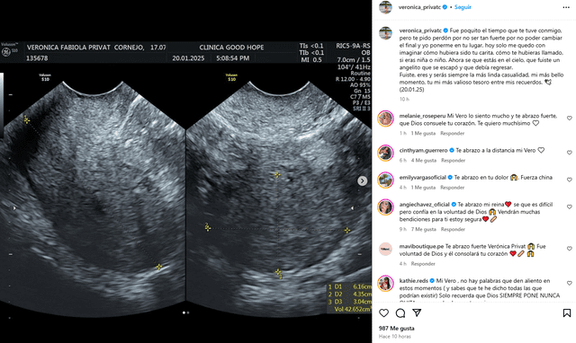 Verónica Privat anunció la perdida de su bebé en su cuenta de Instagram. Foto: Instagram.    