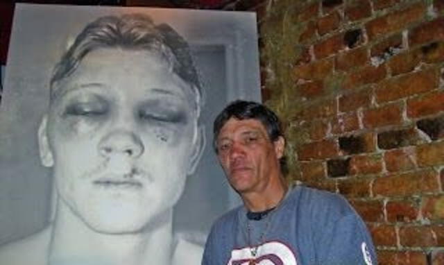  Luis Resto, años después, posando junto a una foto del rostro desfigurado de Collins Jr, para un documental. Foto: Eric Drath