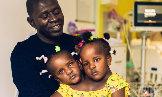 Las hijas de Ibrahima Ndiaye no sobrevivirán si no son sometidas a cirugía de separación. Foto:  Phil Sharp / BBC