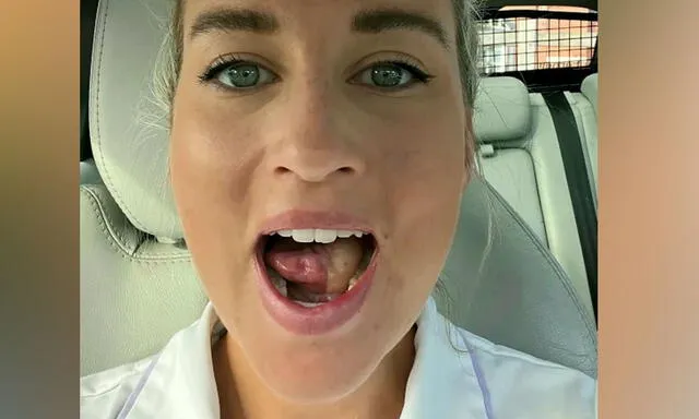 Le extirpan un pedazo de lengua y se la reconstruyen con parte de su muslo: “tengo en la boca pecas de mi pierna”