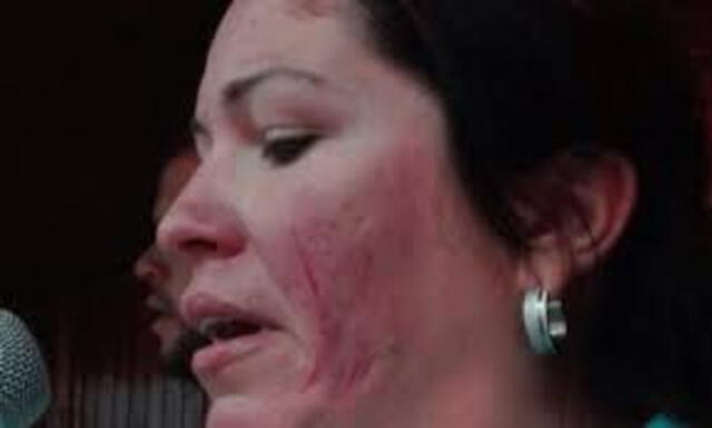 Así quedó el rostro de Corina Machado tras la pelea en el hospital en Mérida. Foto: El Impulso   