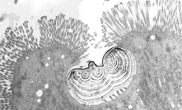 Imagen de microscopio electrónico de transmisión de una partícula hallada en una cripta apical. Foto: Journal of Biology Imagen de microscopio electrónico de transmisión de una partícula hallada en una cripta apical. Foto: Journal of Biology