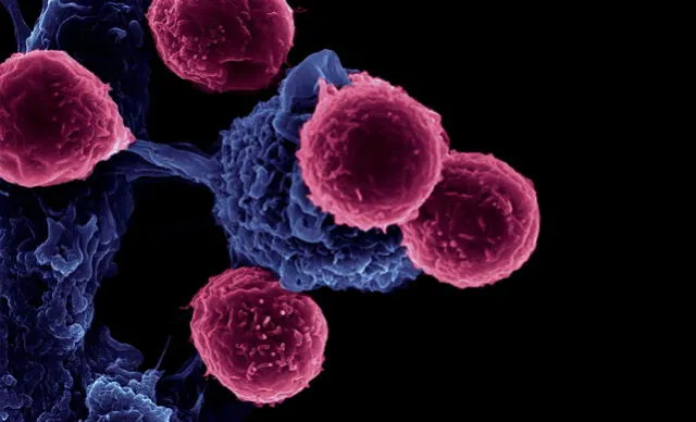 Linfocitos T atacan una célula infectada. Foto: NIH