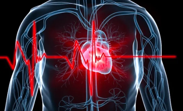  Las enfermedades cardiovasculares son la principal causa de muerte en el mundo. Foto: Sociedad Interamericana de Cardiología   