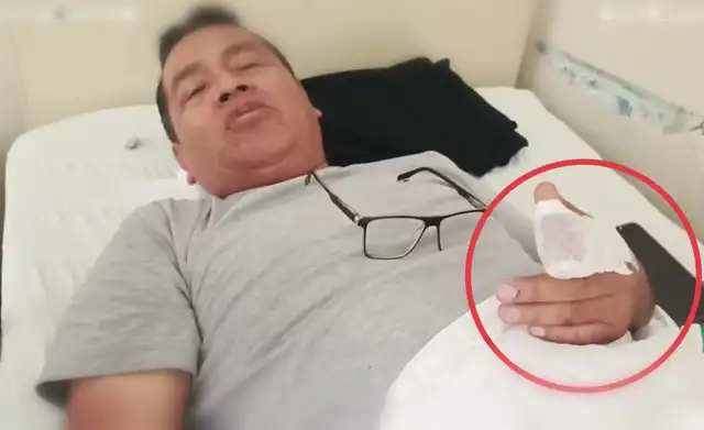 Sereno terminó con un dedo mutilado cuando intentaba detener a un hombre denunciado por hostigar a los vecinos de la urbanización Sol y Luz de Trujillo. Foto: Prensa Total/Facebook   