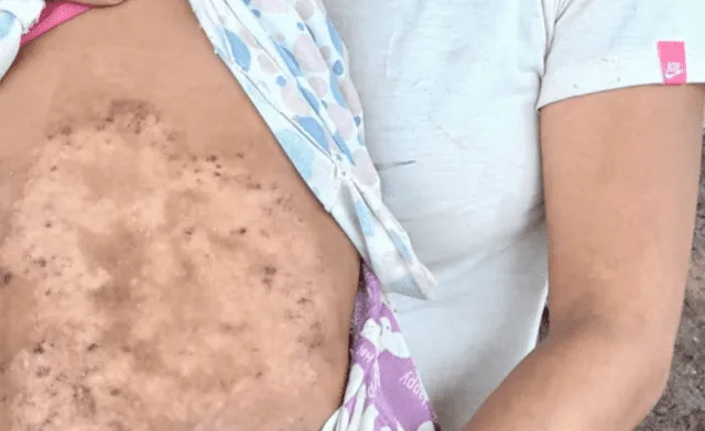 Niños achuar se encuentran intoxicados por la presencia de metales pesados en sus ríos. Foto: Cuencas Sagradas Niños achuar se encuentran intoxicados por la presencia de metales pesados en sus ríos. Foto: Cuencas Sagradas