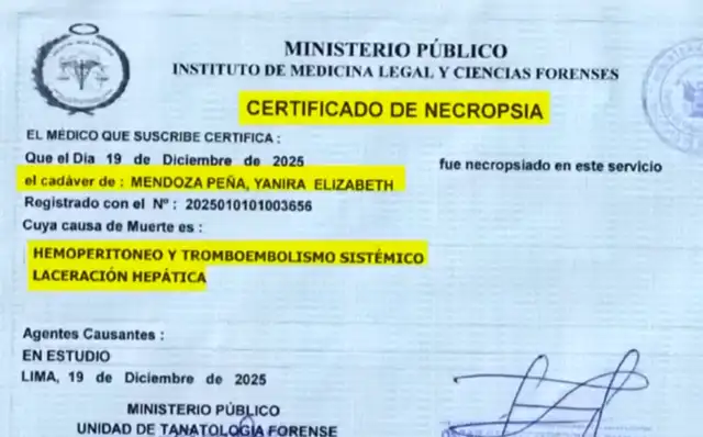 Yanira falleció por una hemorragia interna. Foto: Día D   